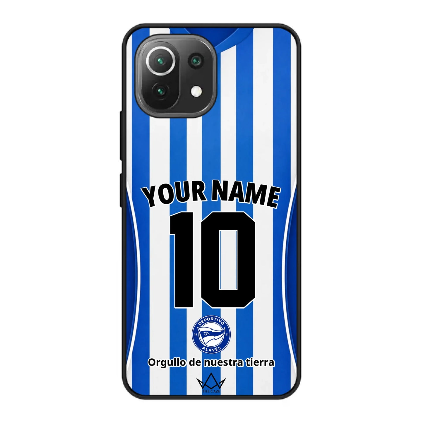 Xiaomi Mi 11 Lite phone case