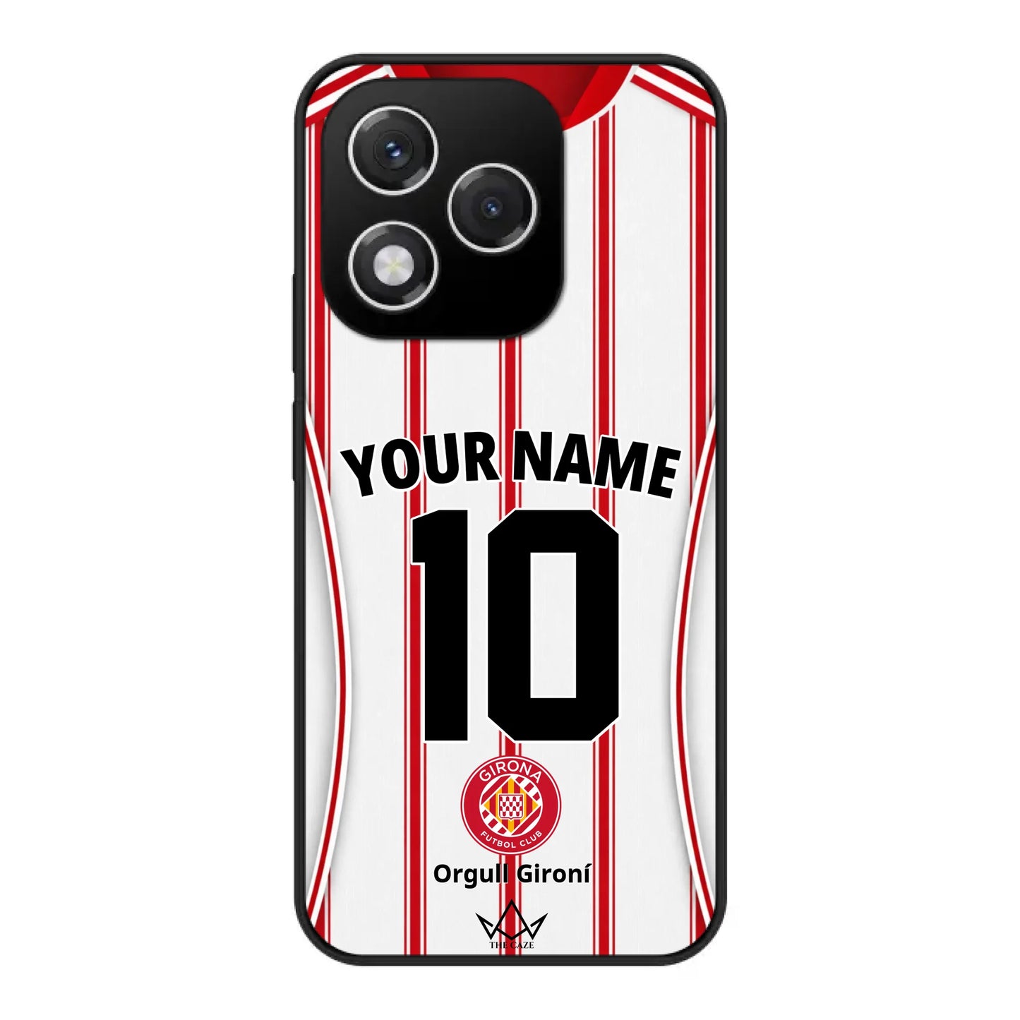 Honor 400 Lite custom case