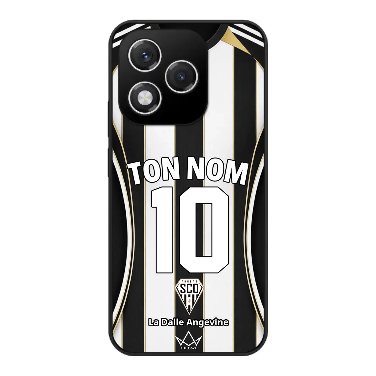 Honor 400 Lite custom case