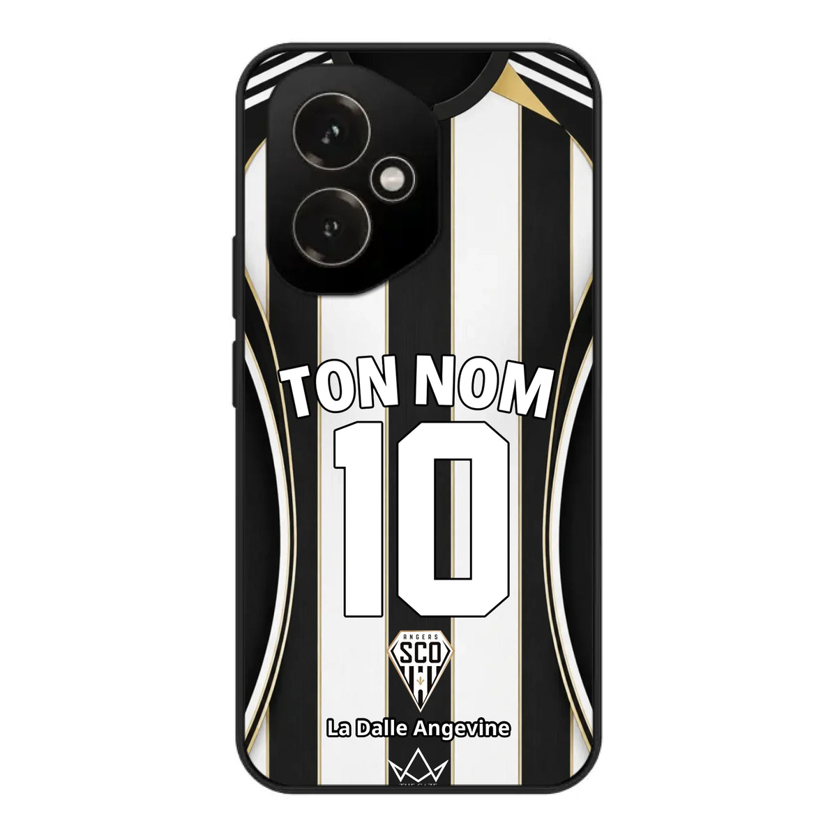 Honor 400 clear phone case